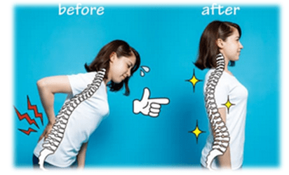 work from home neck pain and back pain strain on eyes spinal cord. posture correction belt. body shape wear hunching slouching working on laptop cell phone